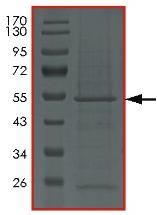 Recombinant Human Protein kinase Y linked