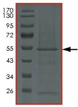 SDS-PAGE - Recombinant Human Protein kinase Y linked (AB179953)
