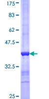 Recombinant Human Protein S