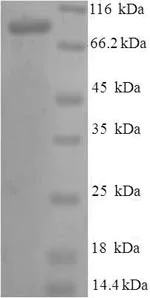 SDS-PAGE - Recombinant Human Protein S (Tagged) (AB236338)
