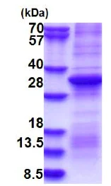 SDS-PAGE - Recombinant Human Prothrombin protein (denatured) (Tag Free) (AB180268)