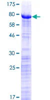 SDS-PAGE - Recombinant Human PRPF31 protein (GST tag N-Terminus) (AB131853)