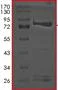 SDS-PAGE - Recombinant Human PRPF4B protein (AB201398)