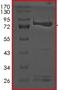 SDS-PAGE - Recombinant Human PRPF4B protein (AB201398)