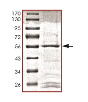 SDS-PAGE - Recombinant Human PRPK protein (AB169728)