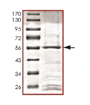 SDS-PAGE - Recombinant Human PRPK protein (AB169728)