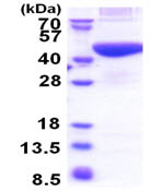 SDS-PAGE - Recombinant Human PRPSAP2 protein (His tag N-Terminus) (AB174429)