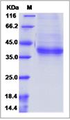SDS-PAGE - Recombinant Human PRRG2 protein (Fc Chimera) (AB276586)