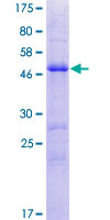SDS-PAGE - Recombinant Human PRRG4 protein (AB163973), expandable thumbnail