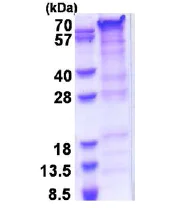 SDS-PAGE - Recombinant Human PRRT2 protein (His tag N-Terminus) (AB177630)
