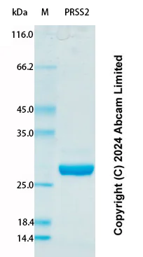SDS-PAGE - Recombinant Human PRSS2 Protein Standard (AB323026)