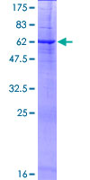 SDS-PAGE - Recombinant Human PRSS21/ESP1 protein (AB161209), expandable thumbnail