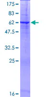 SDS-PAGE - Recombinant Human PRSS21/ESP1 protein (GST tag N-Terminus) (AB161209)