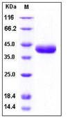 SDS-PAGE - Recombinant Human PRSS8 protein (His tag) (AB276240)