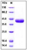 SDS-PAGE - Recombinant Human PRSS8 protein (His tag) (AB276240)