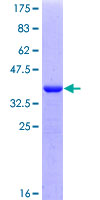 SDS-PAGE - Recombinant Human PRX-2 protein (GST tag N-Terminus) (AB162560)