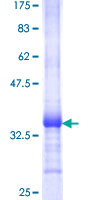 Recombinant Human PSCA protein