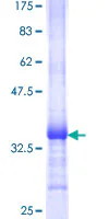 SDS-PAGE - Recombinant Human PSCA protein (GST tag N-Terminus) (AB159927)