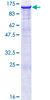 SDS-PAGE - Recombinant Human PSD95 protein (AB131874)