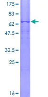 SDS-PAGE - Recombinant Human PSG1 protein (AB114940)
