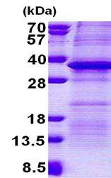 SDS-PAGE - Recombinant Human PSG5 protein (denatured) (AB167890), expandable thumbnail