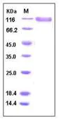 SDS-PAGE - Recombinant Human PSGL-1 protein (Fc Chimera His Tag) (AB276279)
