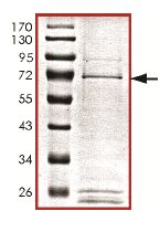 Recombinant Human PSKH1 protein