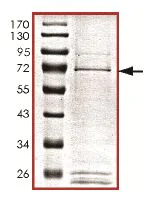 SDS-PAGE - Recombinant Human PSKH1 protein (AB131708)