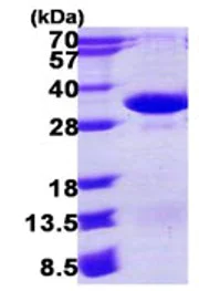 SDS-PAGE - Recombinant Human PSMA4 protein (His tag N-Terminus) (AB123216)