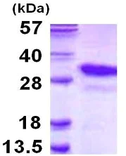 SDS-PAGE - Recombinant Human PSMA8 protein (His tag N-Terminus) (AB116154)