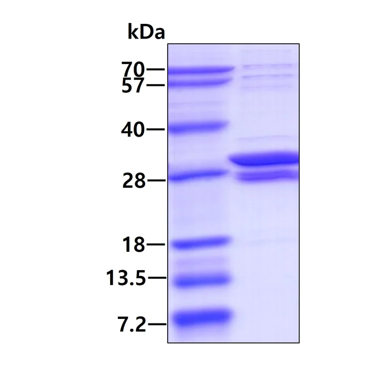SDS-PAGE - Recombinant Human PSMB10/MECL1 protein (AB113577)