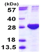 SDS-PAGE - Recombinant Human PSMB4 protein (AB115721)