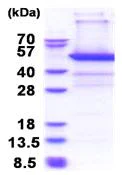 SDS-PAGE - Recombinant Human PSMD11 protein (denatured) (His tag N-Terminus) (AB174394)