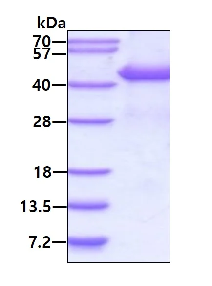 SDS-PAGE - Recombinant Human PSMD13 protein (denatured) (His tag N-Terminus) (AB181912)