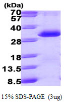 SDS-PAGE - Recombinant Human PSME1 protein (AB99961)