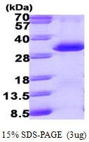 SDS-PAGE - Recombinant Human PSME1 protein (His tag N-Terminus) (AB99961)