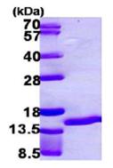 Recombinant Human Psoriasin protein