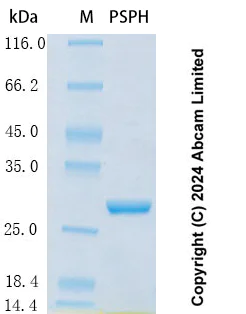 SDS-PAGE - Recombinant Human PSPH Protein Standard (His tag) (AB323154)