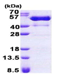 SDS-PAGE - Recombinant Human PSTPIP1 protein (His tag N-Terminus) (AB167828)