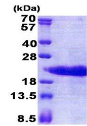SDS-PAGE - Recombinant Human PTMA protein (His tag N-Terminus) (AB171705)