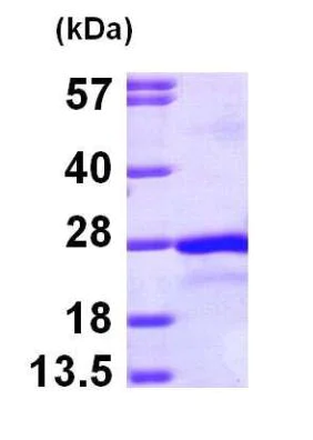 SDS-PAGE - Recombinant Human PTP4A2/PRL2 protein (His tag N-Terminus) (AB100985)