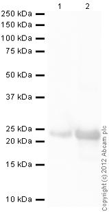 Western blot - Recombinant Human PTP4A3/PRL-R protein (His tag N-Terminus + His tag N-Terminus) (AB87716)