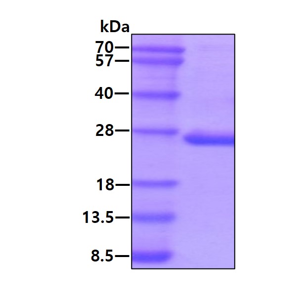 SDS-PAGE - Recombinant Human PTPMT1 protein (His tag N-Terminus) (AB116204)