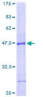 SDS-PAGE - Recombinant Human PTPN22 protein (AB132055)