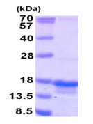 SDS-PAGE - Recombinant Human PTRHD1 protein (His tag N-Terminus) (AB187434)