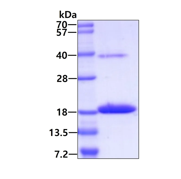 SDS-PAGE - Recombinant Human PTS/PTPS protein (AB92928)
