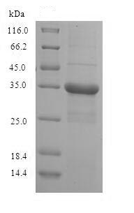 SDS-PAGE - Recombinant Human Putative 40S ribosomal protein-like (His tag) (AB225984), expandable thumbnail