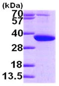 SDS-PAGE - Recombinant Human PYCR1 protein (His tag N-Terminus) (AB101948)