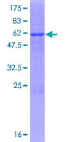 Recombinant Human PYCR2 protein