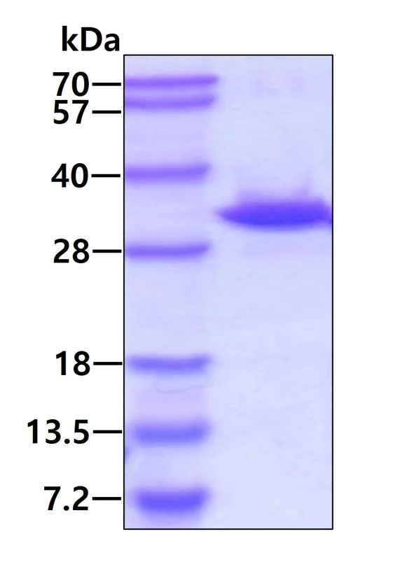 SDS-PAGE - Recombinant Human PYCRL protein (His tag N-Terminus) (AB139626)